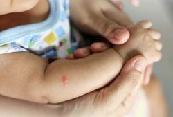 Dengue en niños: cuáles son los riesgos y las alarmas 